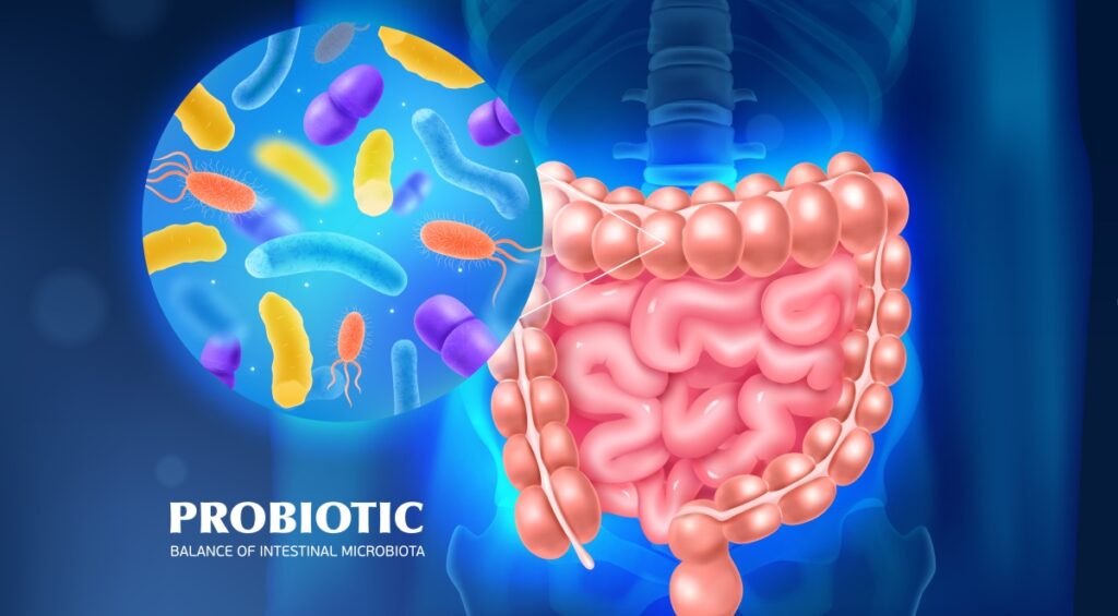 The Ultimate Guide To Probiotic Foods What To Eat For A Healthy Gut